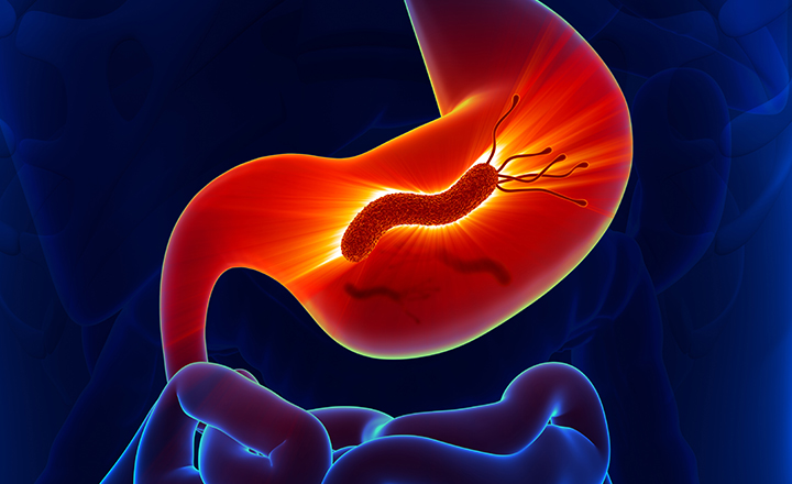 H.Pylori Antigen Test